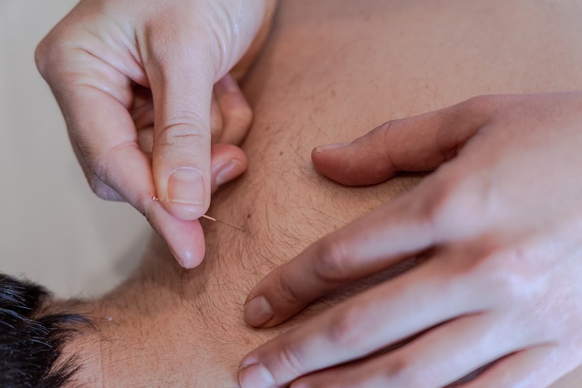 Catarina Romãozinho - Acupuntura & Massagem photo 2