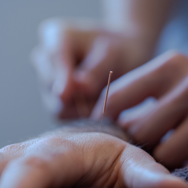 Catarina Romãozinho – Acupuncture & Massage